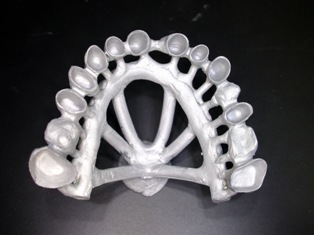 Gerüst für Metallkeramikbrückejpg